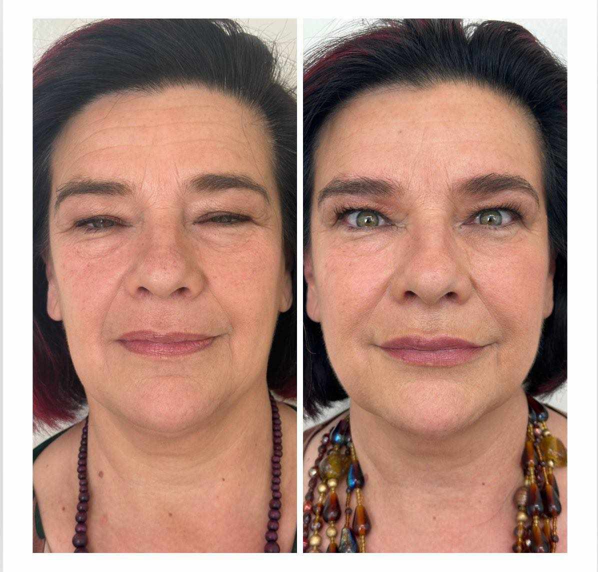 Extravagant beauty: Full face remake by dr. Vivian Jurković
